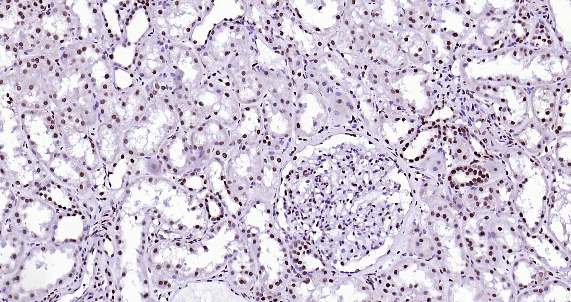 人组蛋白H3（核内参）即用型免疫组化试剂盒-IHC0102H